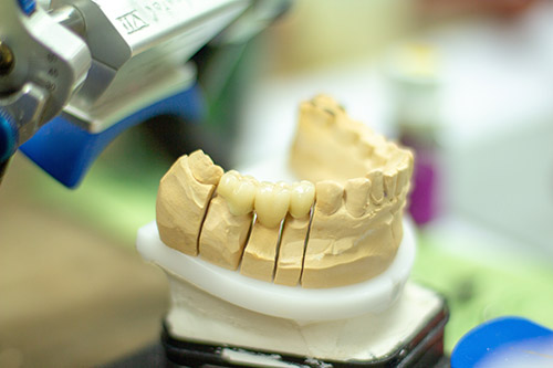 MAXILLA s.r.o. Protetická stomatológia